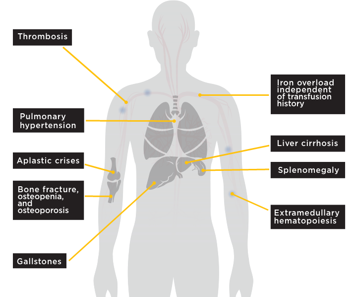 PK Deficiency Symptoms in Human body